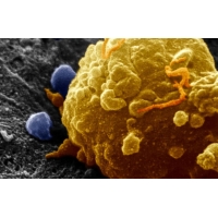 Котеллик – инновационный препарат для таргетной терапии меланомы